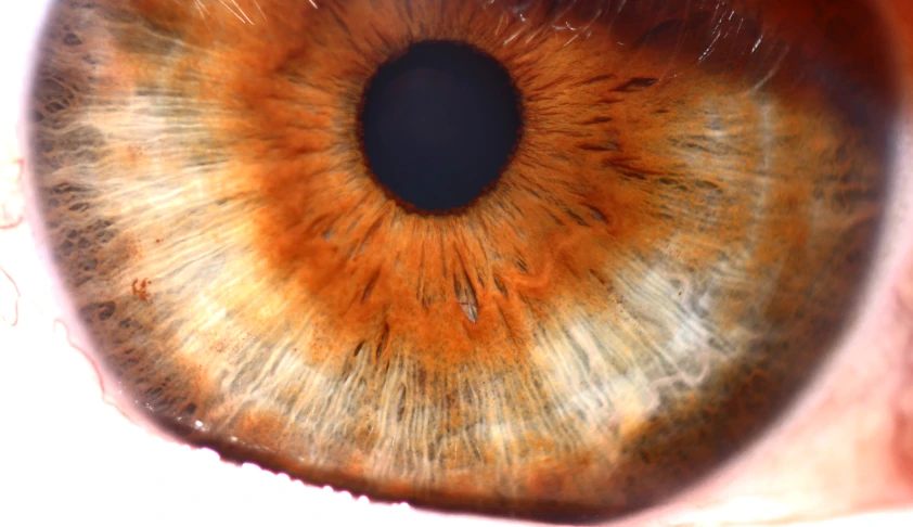 an eye with an iris is shown close up