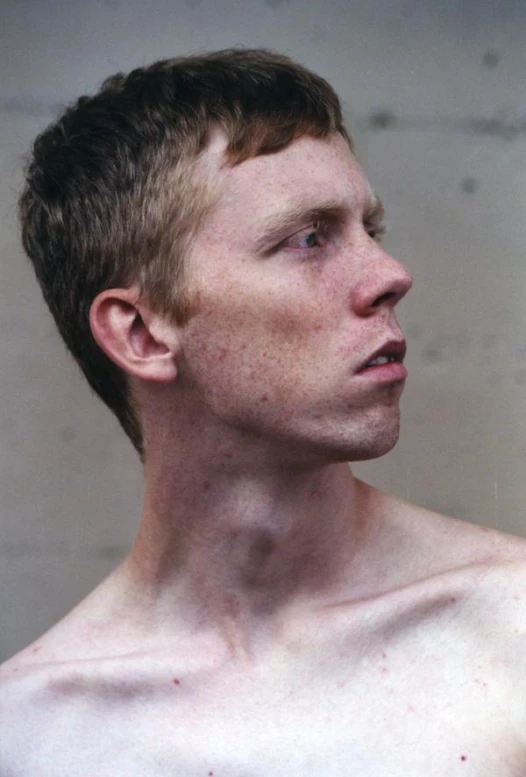 a man with freckled shirtless chest next to white wall