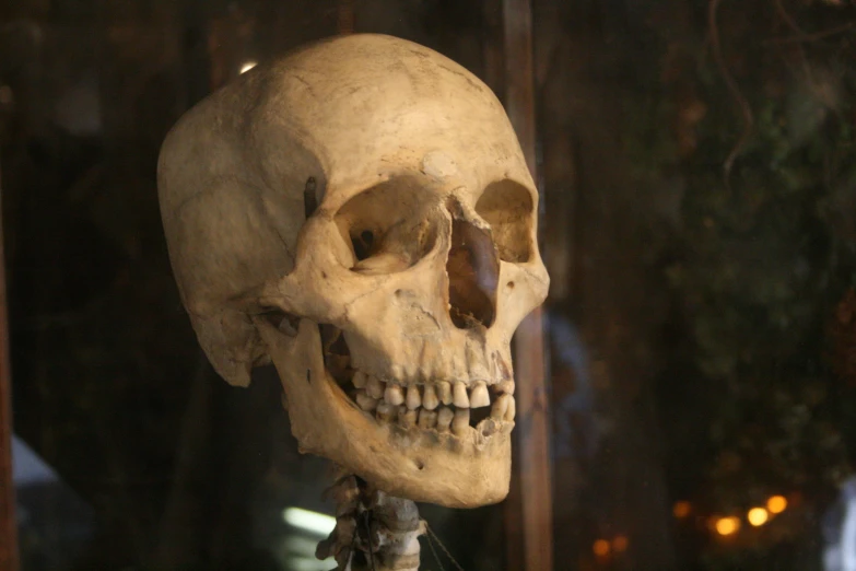 a human skull that is on a shelf