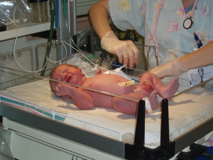 a newborn child being hooked up to a monitor