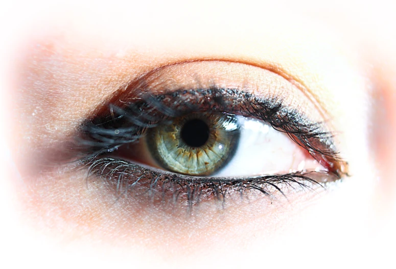 a persons eye showing an extremely light brown color