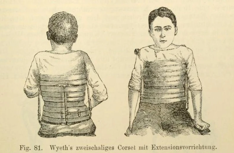 a book showing the back and sides of a man wearing a back ce