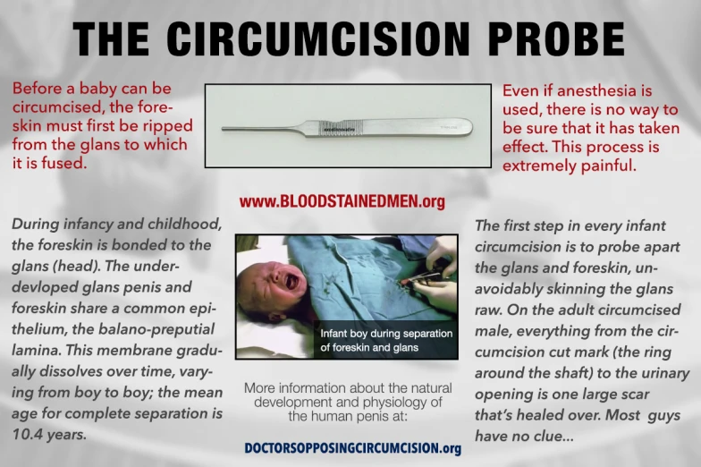 a poster describing the process of crum clinic procedure