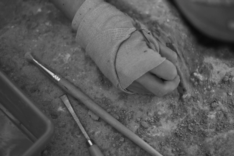 a person holding an injured arm, wearing bandages, and other arts supplies