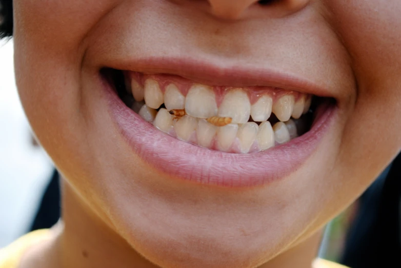 a person wearing a toothbrush with white teeth