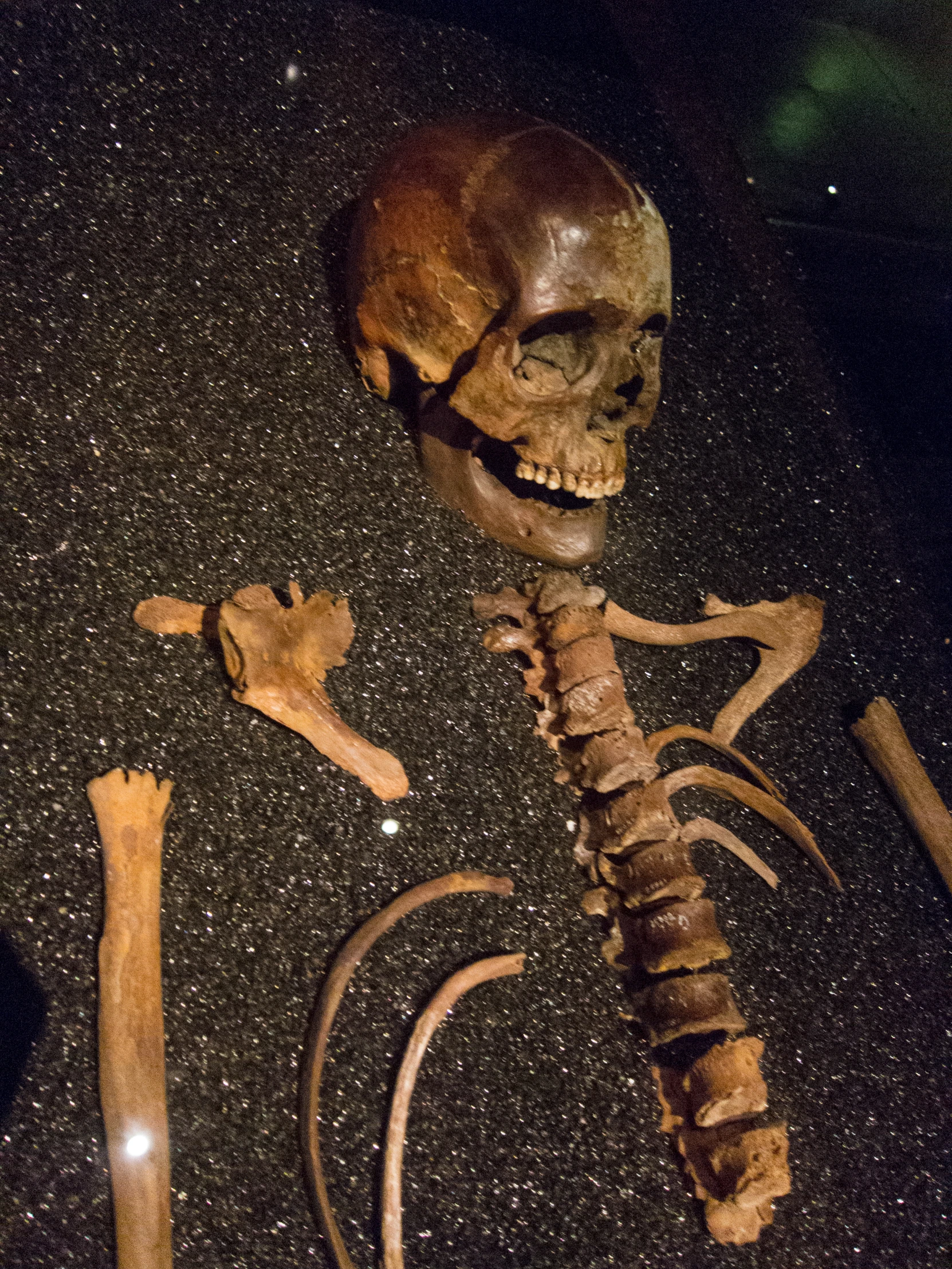 a skeleton is shown with two bones sitting next to it