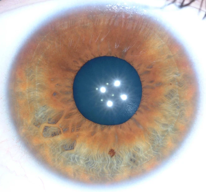 the structure of an eye is brown and orange