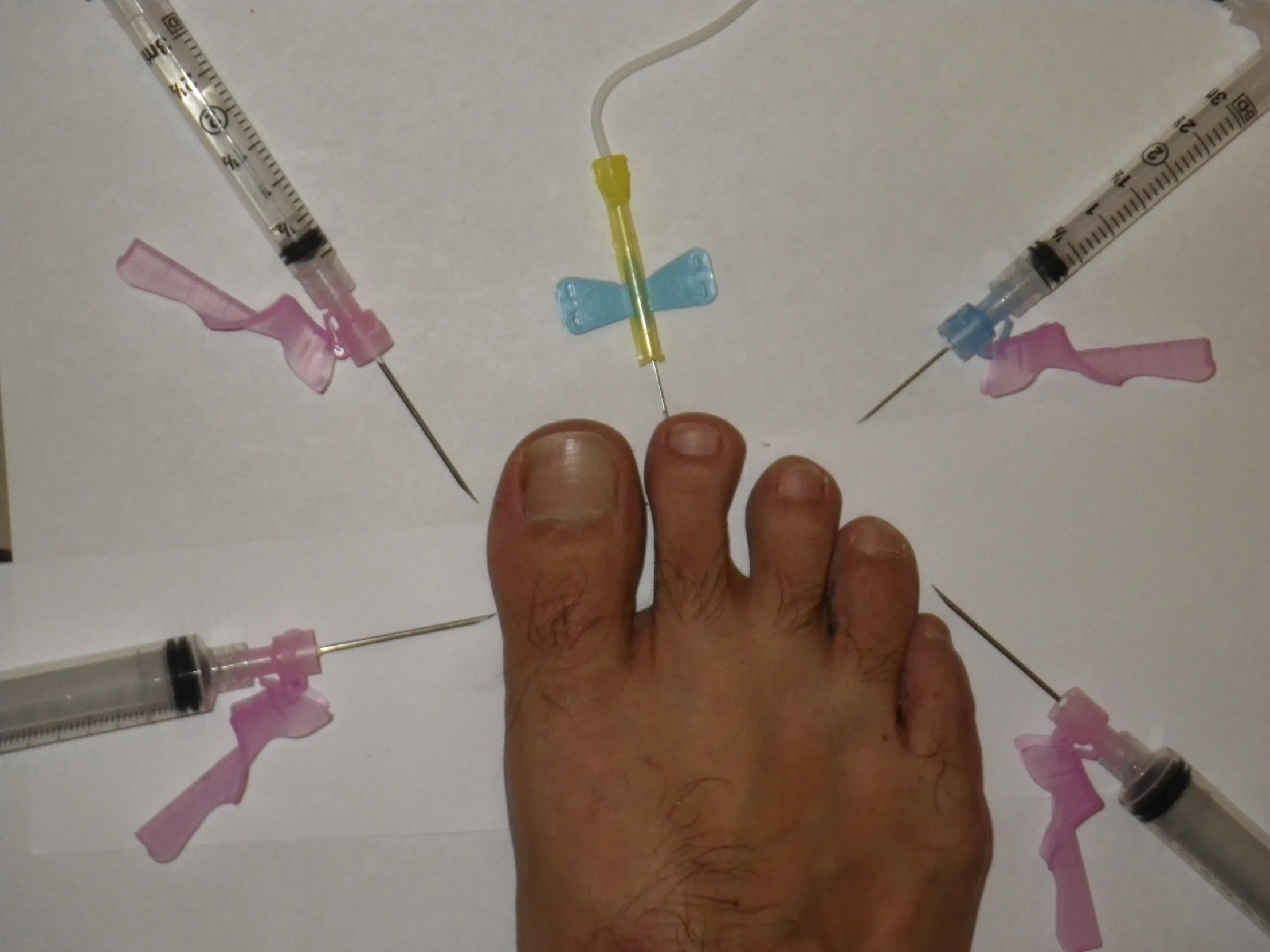 a man's foot surrounded by medical equipment