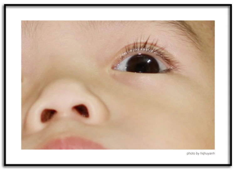 a baby has a blue circle around the eyes