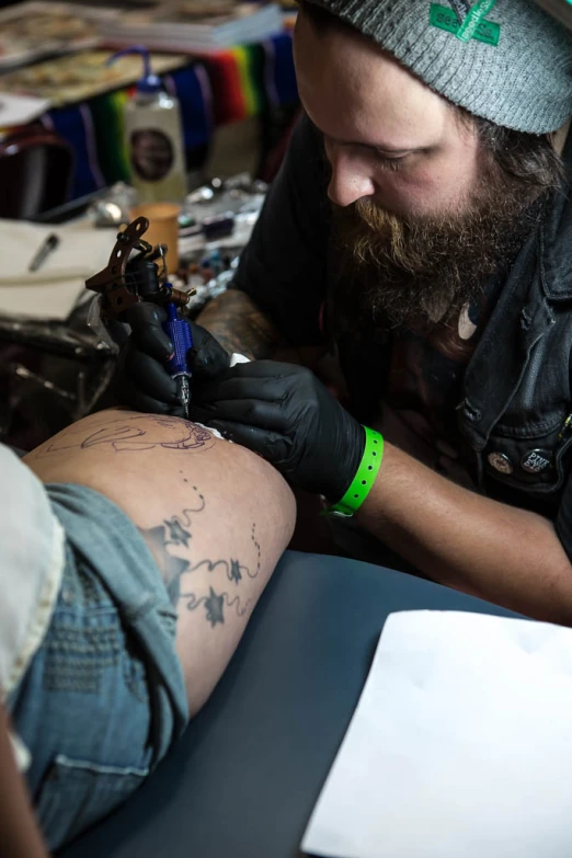 a bearded man has tattoo removal done on his knee