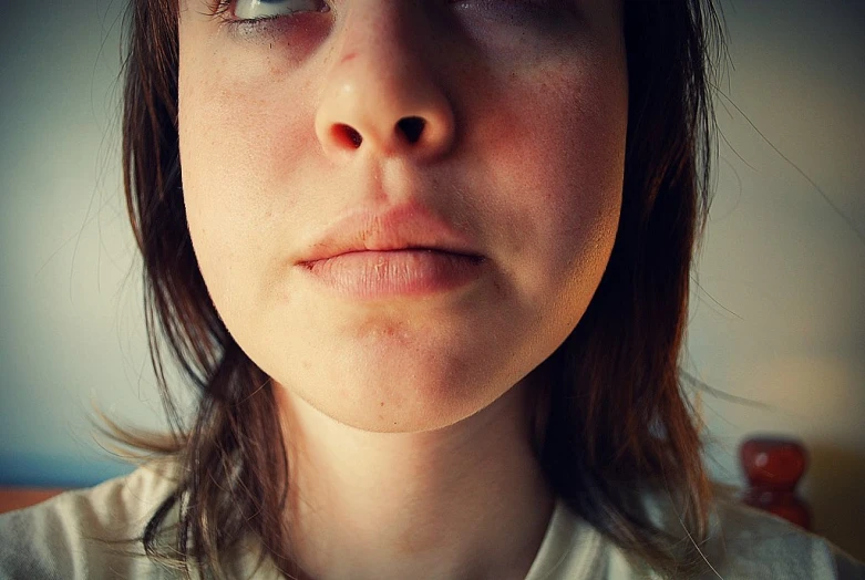 a woman with large, swollen eyes and brown hair is staring into the camera