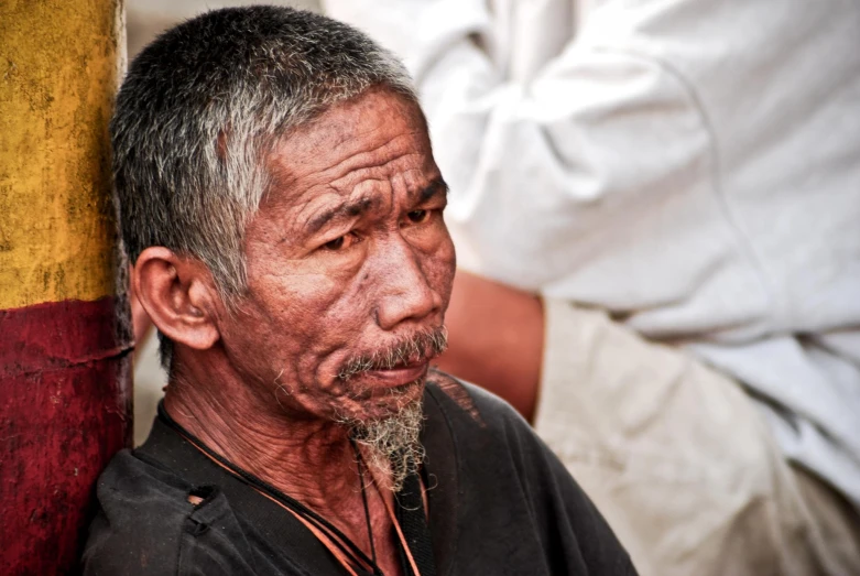 an older man with white frizz on his face