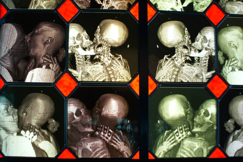 four pictures showing different skulled heads of people