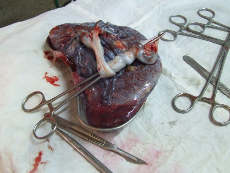 scissors and scalpels sit next to a large piece of meat