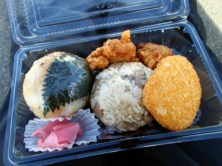 a lunch box filled with donuts, fried food and other pastries
