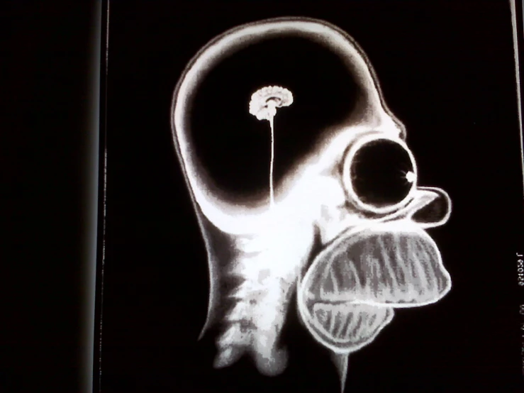 the cross section of a medical x - ray depicts the skull and bones