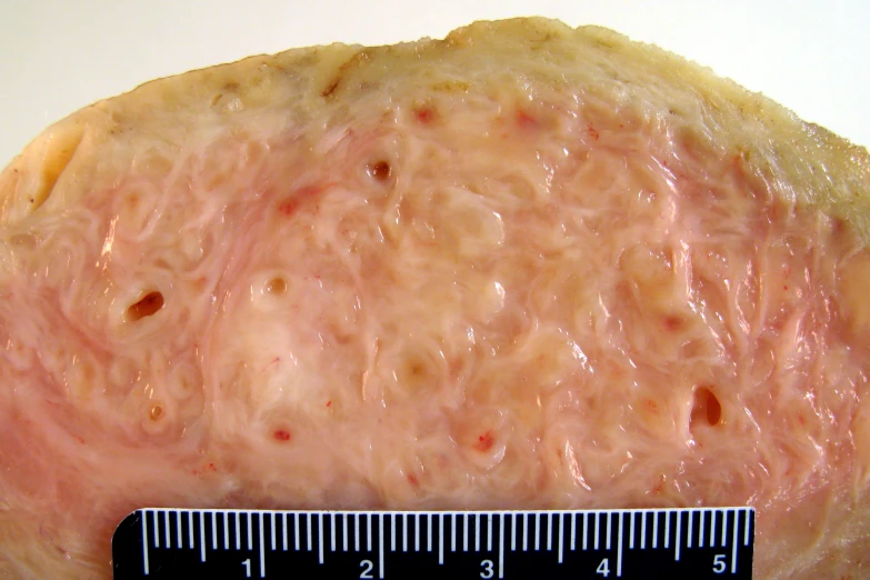 a scale on top of meat is seen here