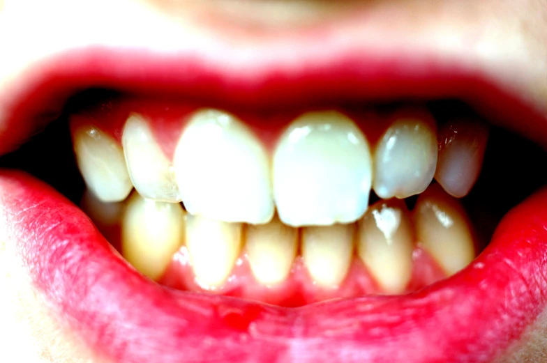a closeup view of the top of a human mouth