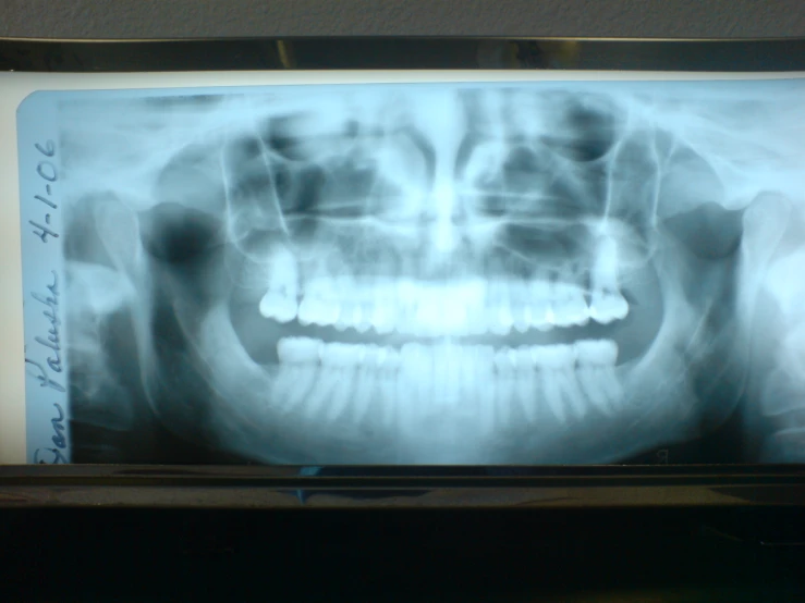 a human body showing teeth in the middle of it