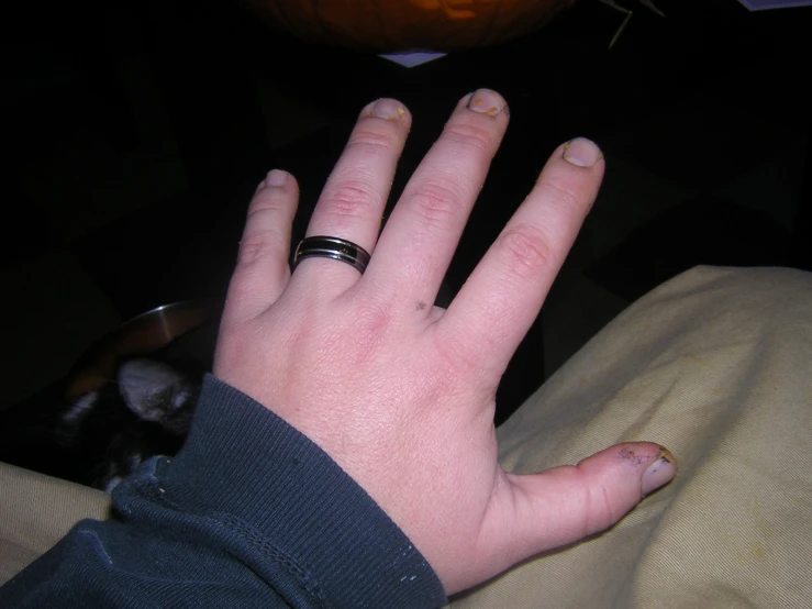 person with ring on their fingers and a cat in background