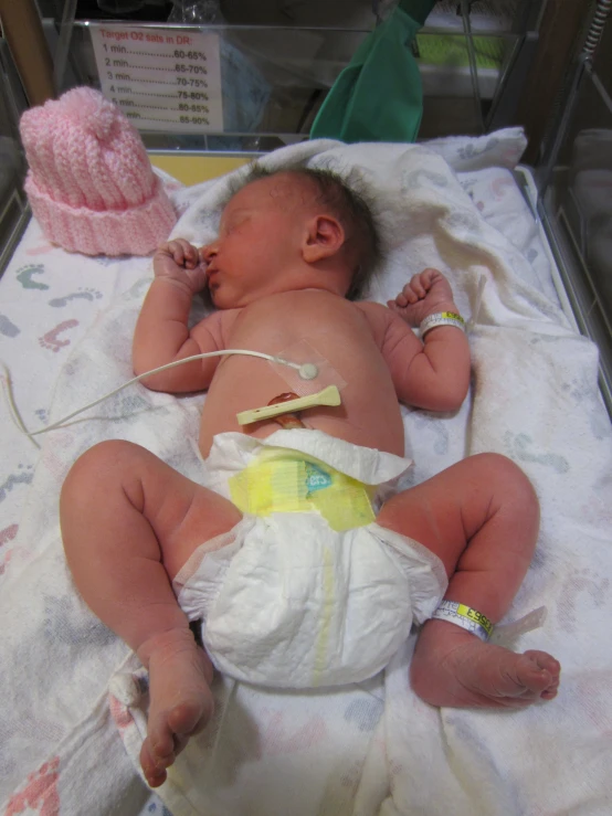 a baby with iv in the middle on a bed next to a knitted object