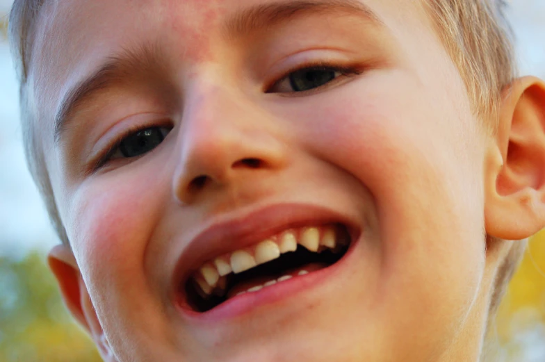 a little boy smiling for the camera with his teeth