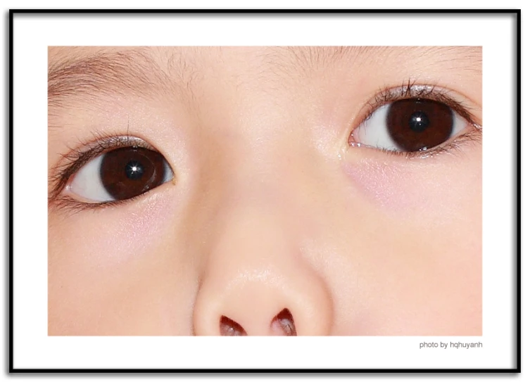an asian child is shown with a pinkish nose