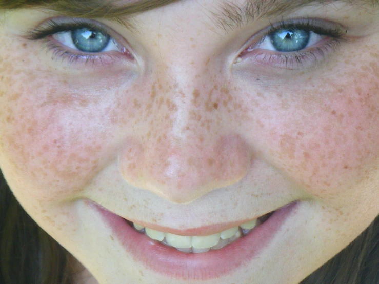 a woman with freckled hair, blue eyes and brown freckled smile