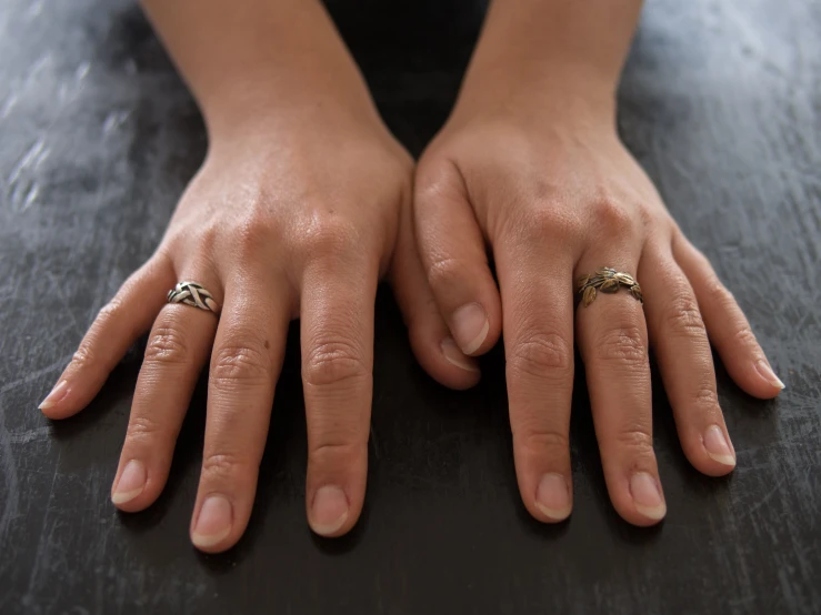 woman's hands with two rings sitting on a gray surface