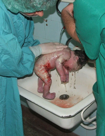 some doctors are performing  to a baby
