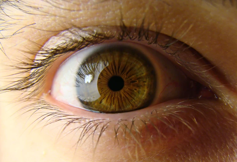 a close up of a person's eye with a yellow iris