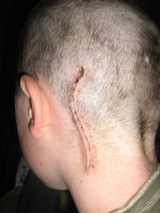 a person with a cut on their forehead