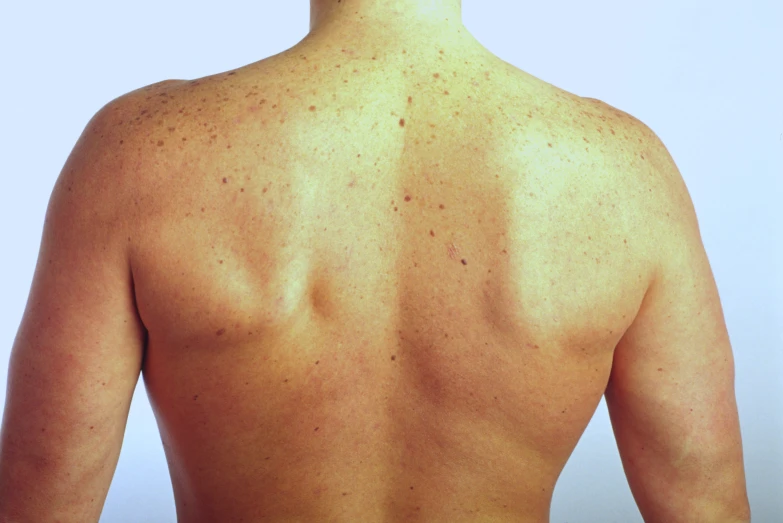 the back of a man's  skin is very small