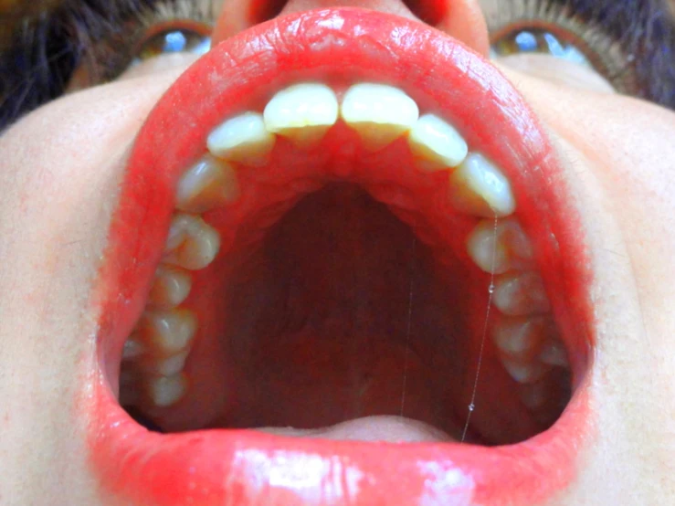 a woman showing her mouth full of teeth and ces