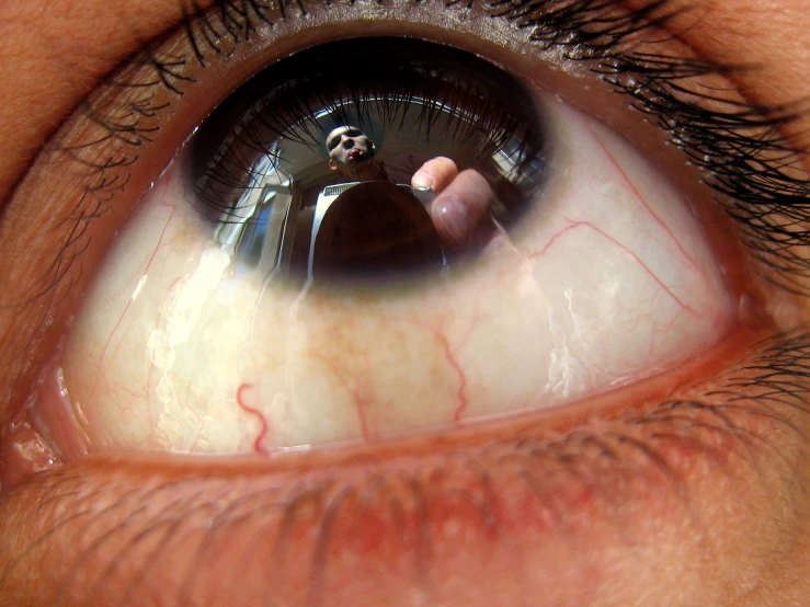 a man is checking the red vein in his eye