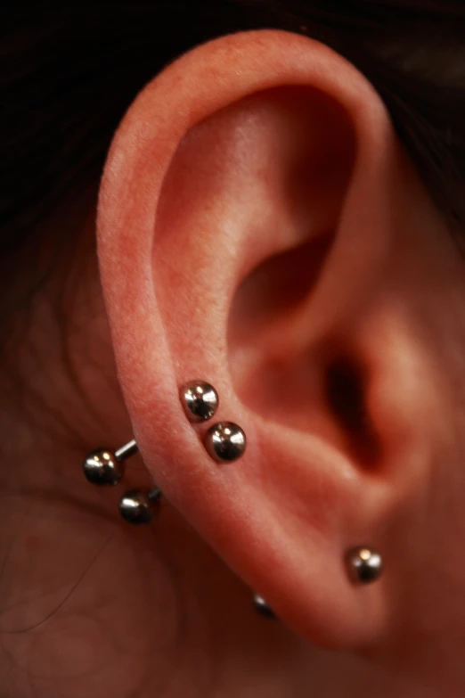 two silver colored balls are pinned into the ear