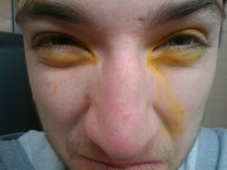 a man looking at the camera with yellow crumbles on his eye