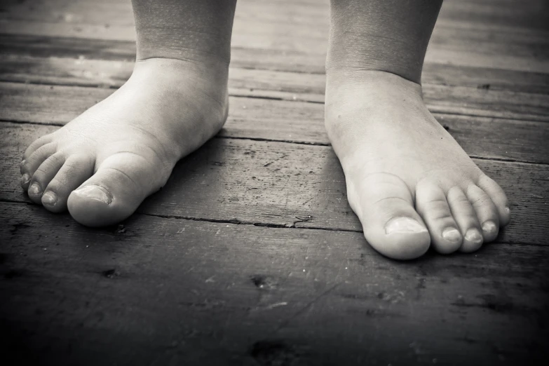 the foot and toe of an old persons feet