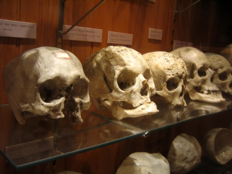 a row of human skulls are on display
