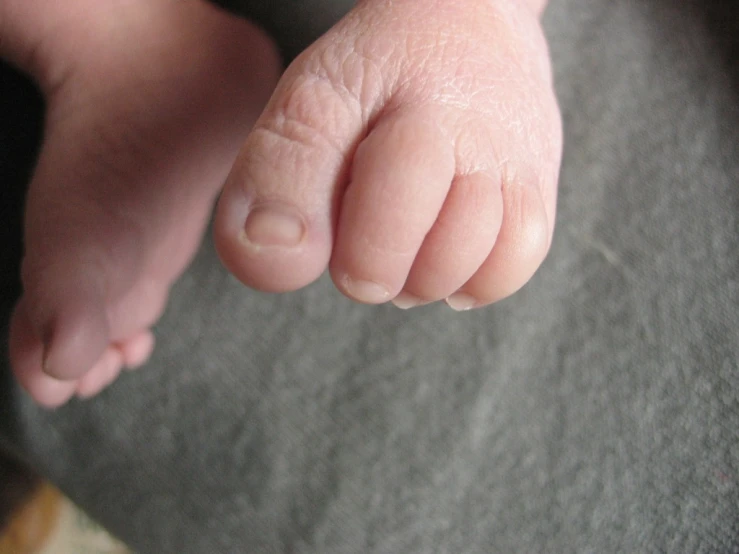 a baby foot with an outstretched thumb sticking out