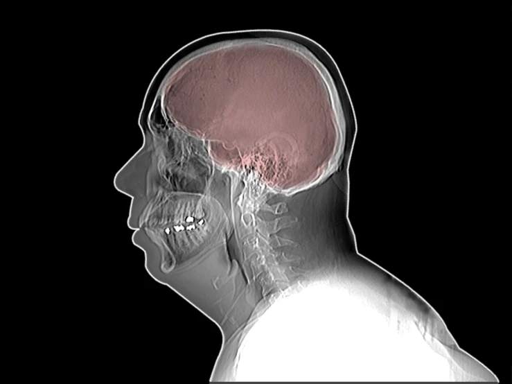 a skull is visible behind the human in