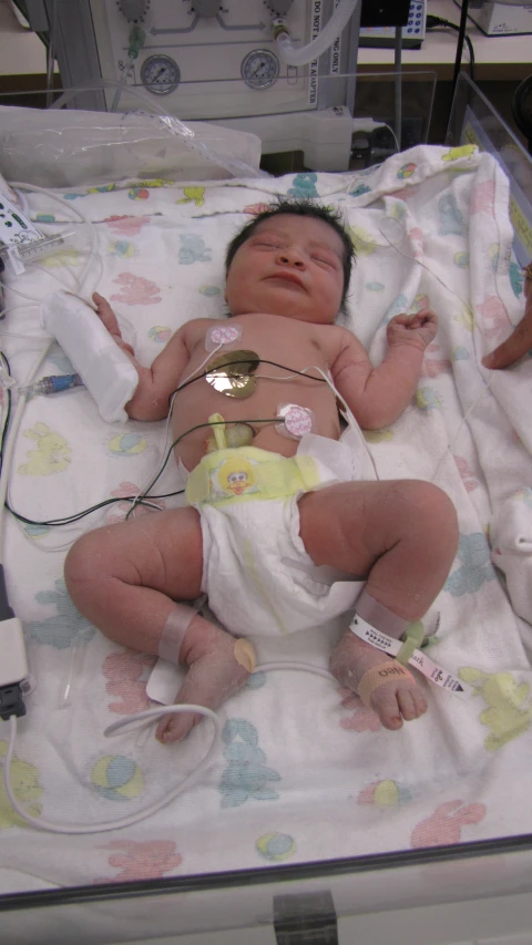 an infant is in a hospital hooked up to equipment