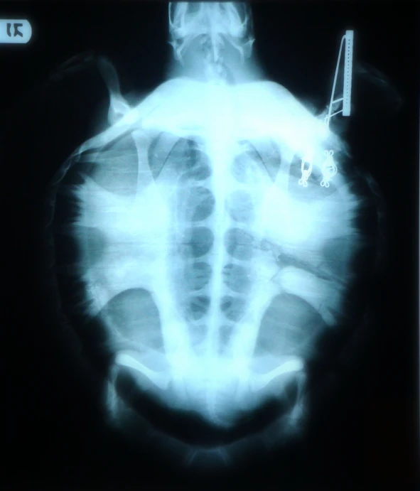 the chest has an xray showing the ribs