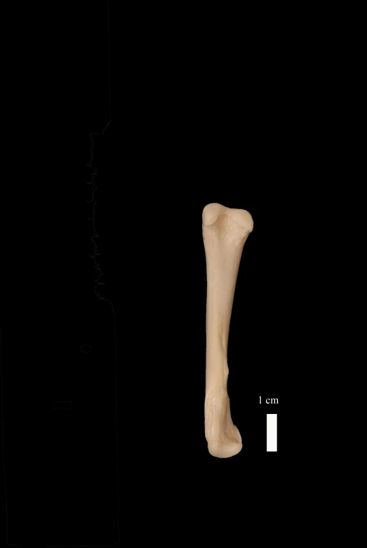 the bones of the lower leg are showing a bone in between one and another part of the legs