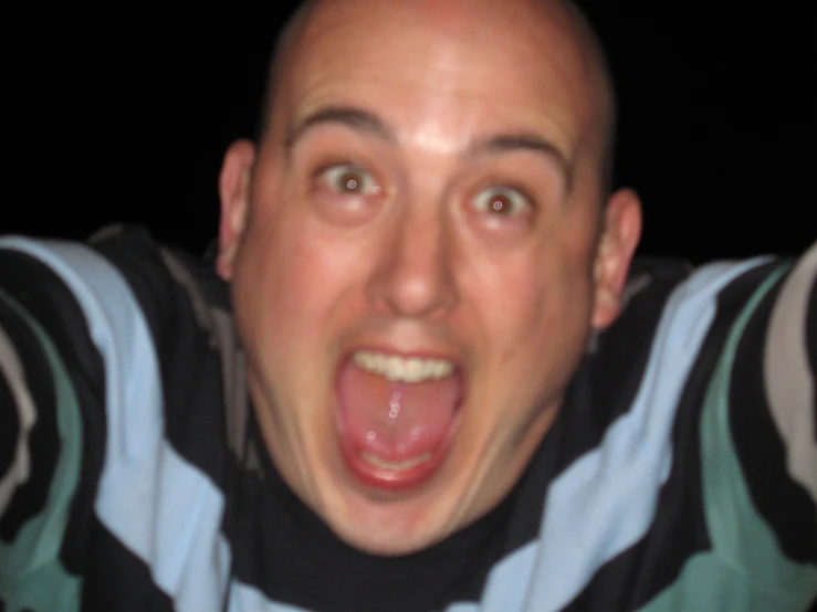 a man making a silly face while wearing a striped shirt