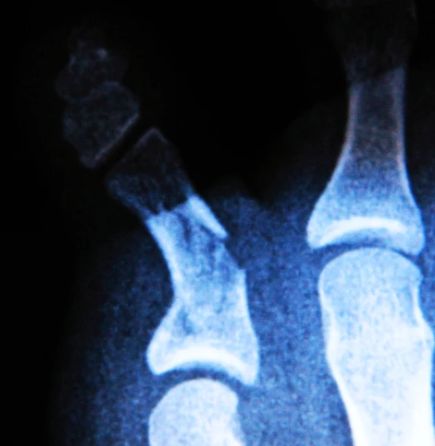 a x - ray shows that someone's feet are not so comfortable