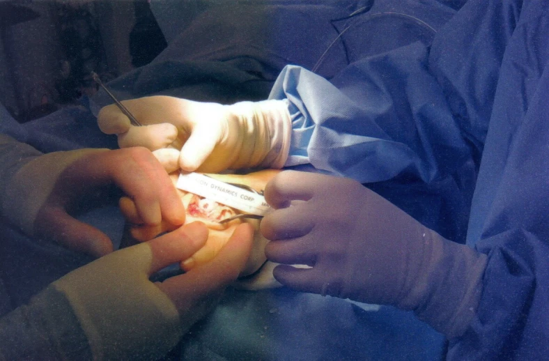 an operating performed for the patient with two hands