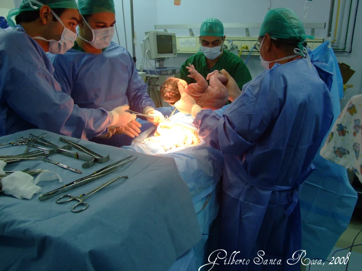 surgeons and nurses standing over a patient in the operating room