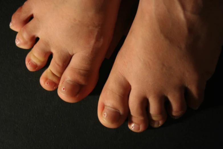 a close up of a person's bare toe and foot