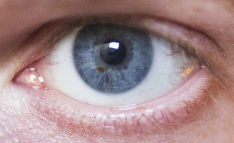 close up of an eye and part of its iris